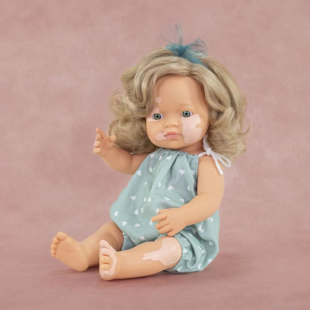 Caucasian Blonde Girl Doll with Vitiligo